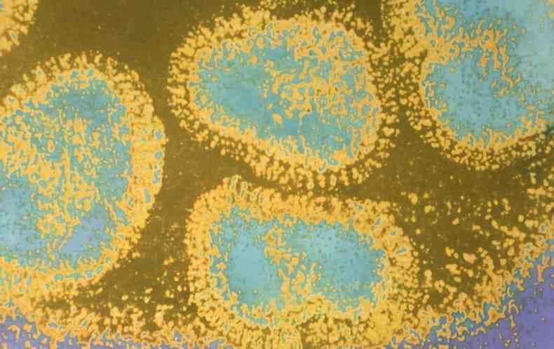 COVID-19: TODO lo que debes saber acerca del Corona Virus !!!