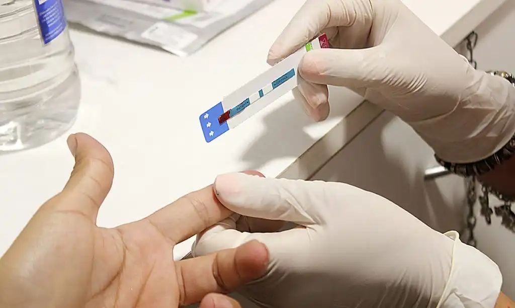 Descubren una nueva variante del VIH más agresiva y contagiosa.