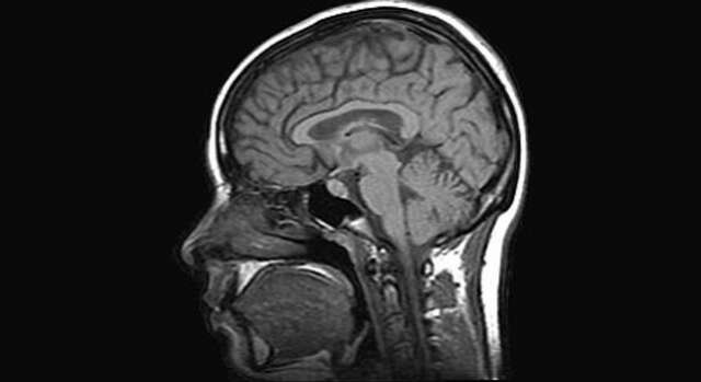 La molécula de la miseria: Descubren la parte del cerebro que provoca, estrés, tristeza etc