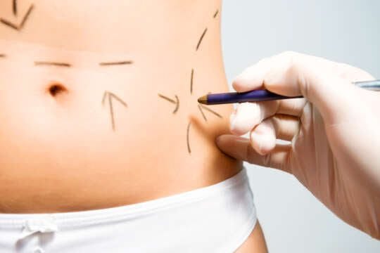 Argentina: Las niñas ya no podrán operarse