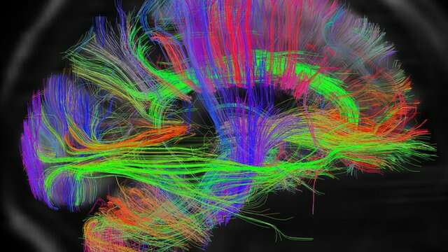 ¿Realmente sólo usamos el 10% de nuestro cerebro?