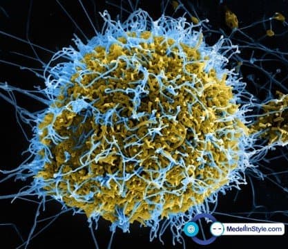 ÉBOLA: ZMapp cura 100% a monos de laboratorio…