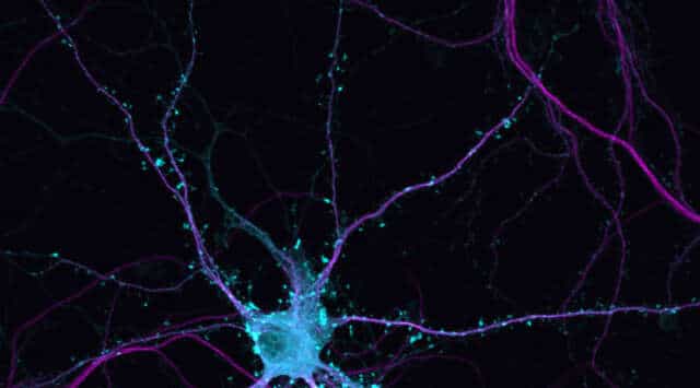Lo sabías? Diariamente nacen 1.400 nuevas neuronas en el cerebro hasta que vamos enjeveciendo