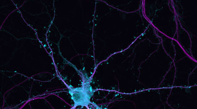 Lo sabías? Diariamente nacen 1.400 nuevas neuronas en el cerebro hasta que vamos enjeveciendo