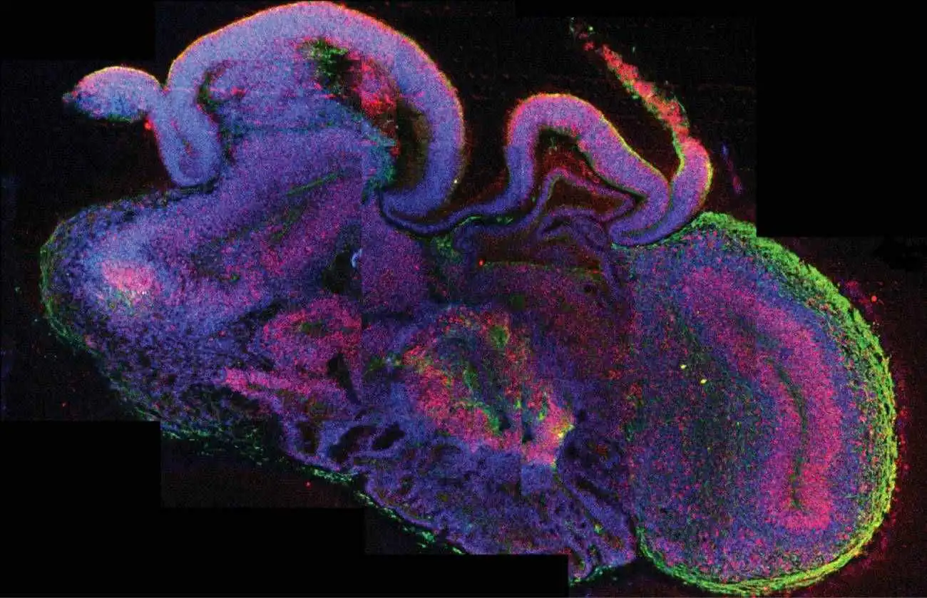 Científicos cultivan mini cerebros humanos en laboratorio.