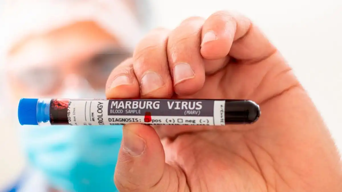 La OMS Alerta sobre el virus de Marburgo, por el brote en Etiopía.