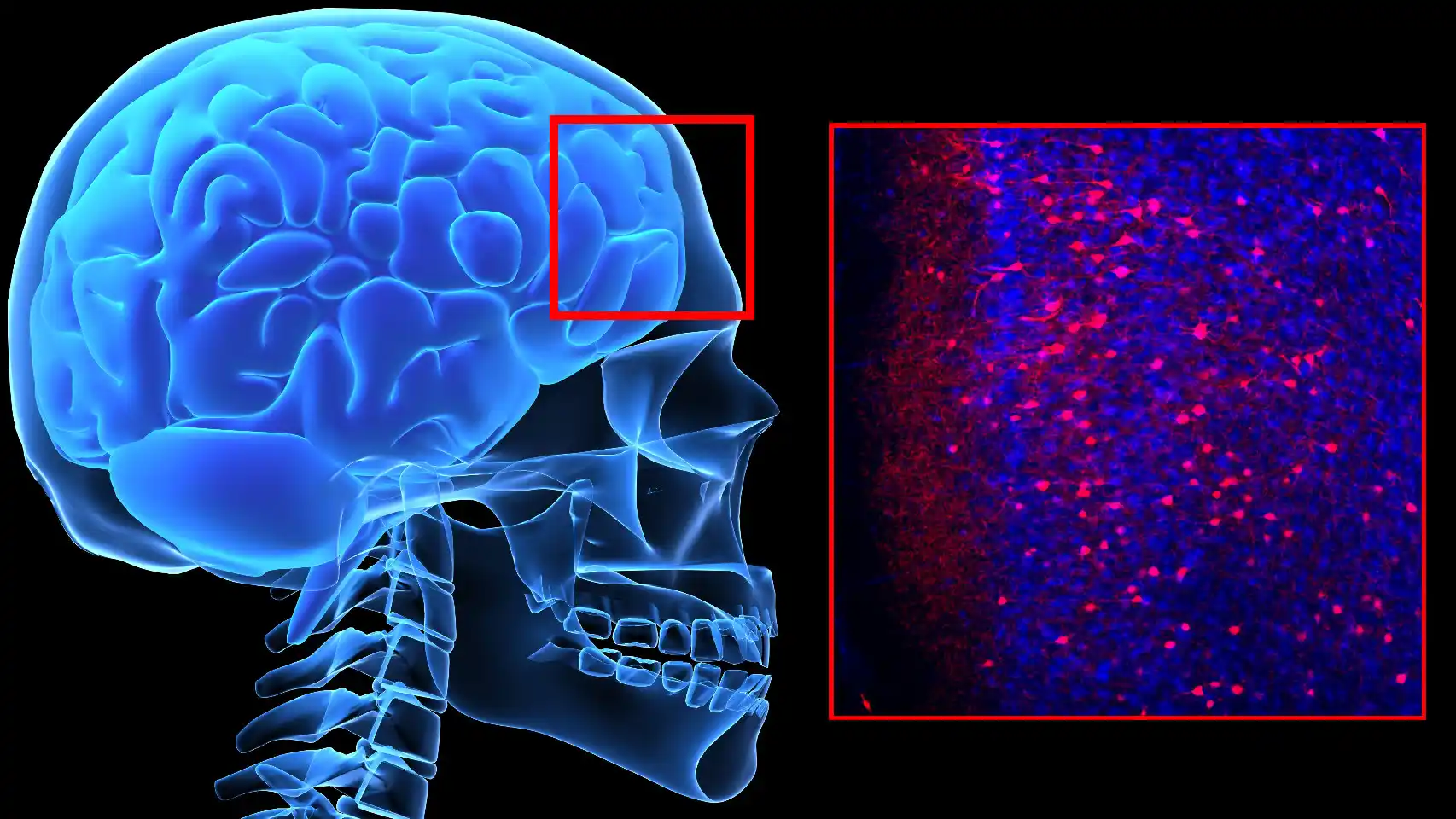 El miedo emerge de cambios químicos en lo más profundo del cerebro