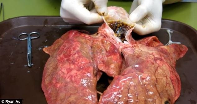 60 cigarrillos: Ésto le hacen a tu cuerpo ( Imágenes Fuertes )