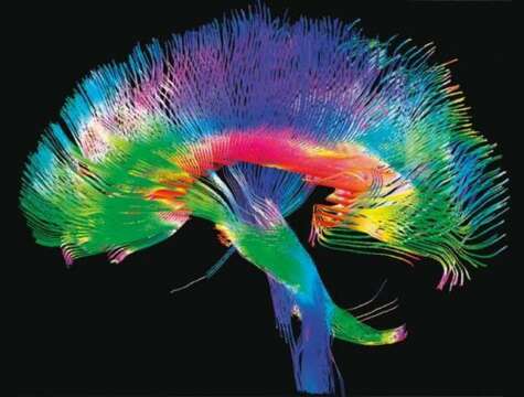 El cerebro humano trabaja al borde la locura