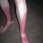 El famoso loco de Coachella