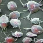 Ciencia: Toxicidad neuronal