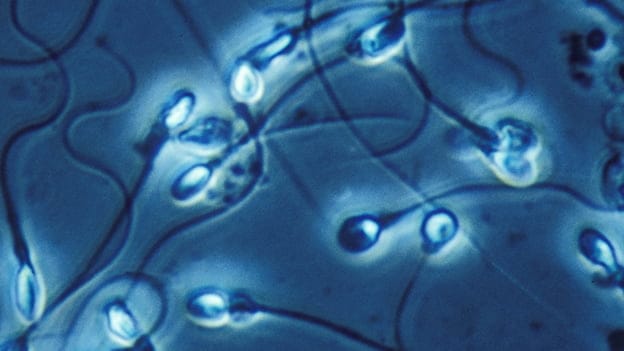 Sexo Invitro: Reproducción sin relaciones sexuales, un futuro alentador