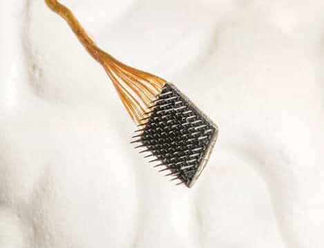 Alan Fritz: Recupera el movimiento por medio de implantes tecnológicos